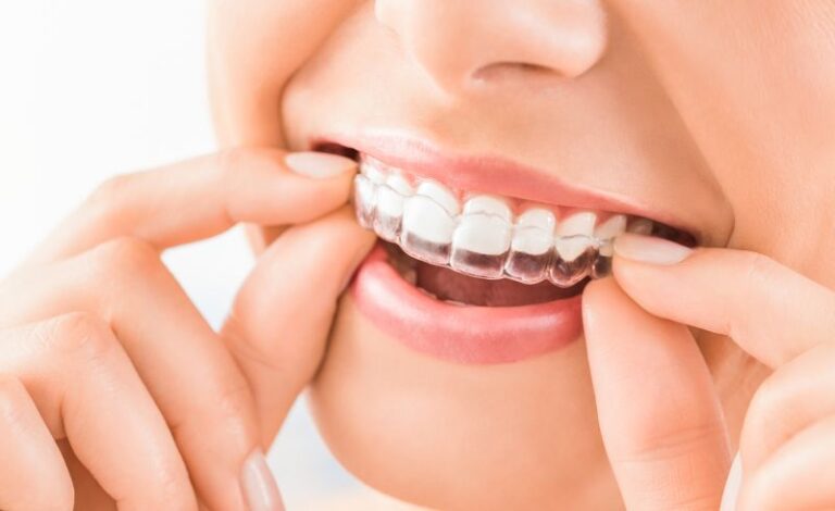 Invisalign in Weston & Pembroke Pines, FL