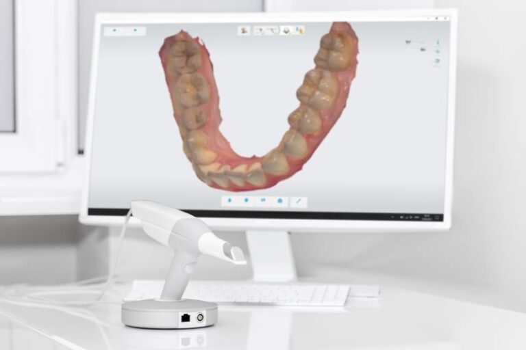 3D Scanner