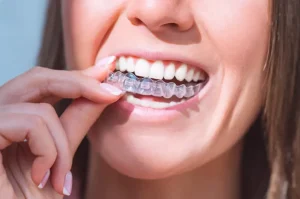 invisalign for crowded crooked teeth